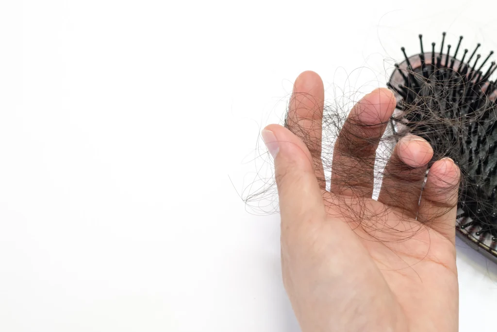 Top 6 Dermatologist-Approved Hair Care Routine for Preventing Hair Loss in the UAE”