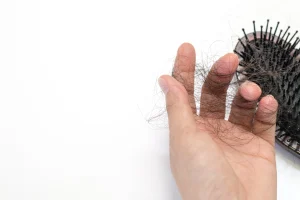 Top 6 Dermatologist-Approved Hair Care Routine for Preventing Hair Loss in the UAE”